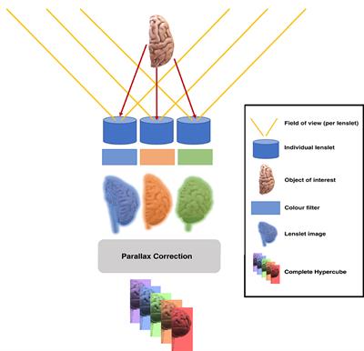 Lightfield hyperspectral imaging in neuro-oncology surgery: an IDEAL 0 and 1 study